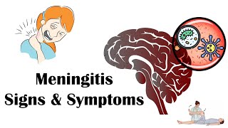 Meningitis - Signs & Symptoms |Most Common Signs & Symptoms Of Meningitis