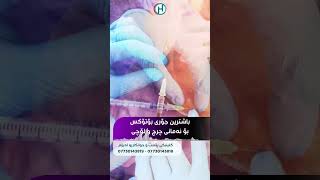 بۆتۆکس بۆ لابردنی چرچ و لۆچی