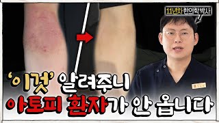 집에서 아토피 없앨 수 있는 방법 TOP 3 (한의학 박사)