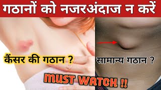 lump in armpit | painful lump under armpit | knot under armpit |