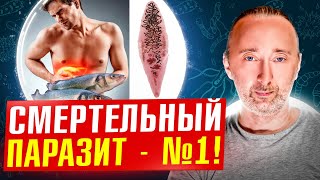 ОПИСТОРХОЗ: эти глисты УБИВАЮТ людей ВОТ ТАК! Ошибки в лечении!