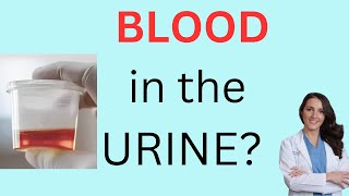 BLOOD in the URINE! Does it mean CANCER?  Don't Panic! Find out what blood in the urine means