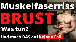 Muskelfaserriss Brust | Was Du tun kannst und welche Übungen Du unbedingt meidest | Schnelle Heilung