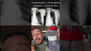 Dreno de tórax borbulhante e a fístula pleural #fisioterapiarespiratória #terapiaintensiva #pulmão