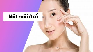 Xem bói ý nghĩa nốt ruồi ở cổ Trái, Phải ở Nam, Nữ có ý nghĩa gì?