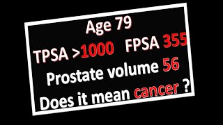 A Man Age 79, PSA over 1000, size 56, Does it Mean Cancer?