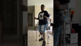 One leg dance move challenge 12 weeks after surgery