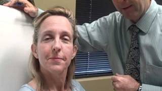 Botox Gilbert AZ Facial Muscles treated with botox