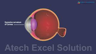 CBSE NCERT Science Class - Refraction Dispersion and Scattering of Light - Human Eye Part -2