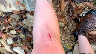 Destroying My Knee In Nature (VLOG 14)