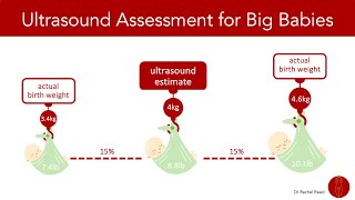 Can Ultrasound Accurately Estimate the Size of a Baby?