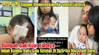 😭😭 Update Terkini Kondisi Baby Gala Sky Setelah Di Op3rasi m4ta Siang Tadi ❗Sedih Banget Liatnya