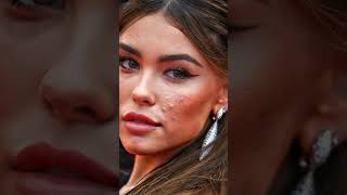 celebrities with acne #celebrity #acne #famous #fashion #model #skin #loveyourself