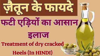 फटी एड़ियों का आसान इलाज |Treatment of dry cracked Heels (In HINDI) Bazm E Ruhaniyat Officel