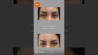 ڕاکێشانی چاو ( چاوی ڕێوی). #تجميل_العيون #eyebrows #تجمیل