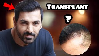 JOHN ABRAHAM| Hair Transplant|Results| Minoxidil| Finasteride|hairstyle| hindi| receding|regrowth