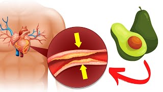 5 FRUTAS PARA ABAIXAR O COLESTEROL ALTO