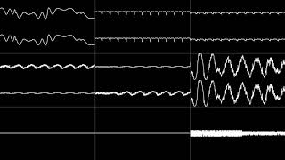 Sonic the Hedgehog 3 (1993 Prototype) - "Launch Base Zone (Act 1)" [Oscilloscope View]