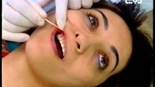 مجموعة ليبرتي الطبية  عيادة الأسنان  أنت أجمل  رنا  العدسات الأسنان اللاصقة Liberty Medical Group  Dental Clinic  Dubai TV Anti Ajmal  Rana  Composite Veneers