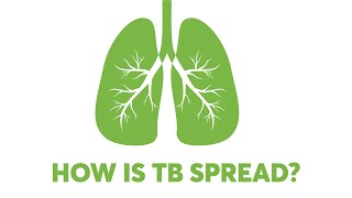 HOW IS TB SPREAD?