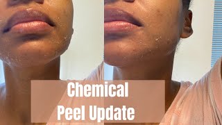 Chemical Peel Check In