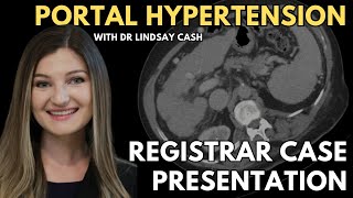 Cirrhosis and Portal Hypertension | CT Abdomen | Registrar Sessions