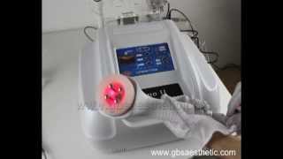 Ultralipo II-Cavitation RF-kavitation fettabbau-lipocavitation-best home cavitation-real review