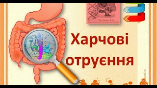 Харчові токсикоінфекції говорить лікар Гук Р. М