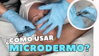 MICRODERMOABRASIÓN 😱 ¿Qué es? ¿Cuándo usarla?