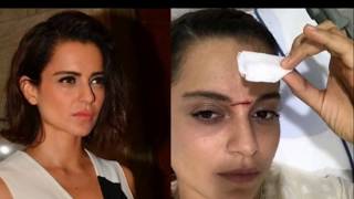 "KANGANA RANAUT" INJURED ON THE SETS OF MANIKARNIKA|THE QUEEN OF JHANSI