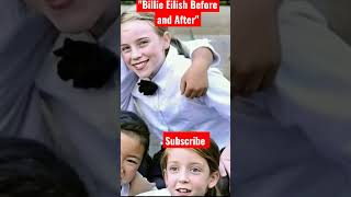 Billie Eilish Before and After