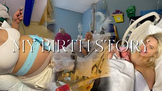 MY BIRTH STORY *20 HOURS IN LABOUR*