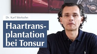 Haartransplantation bei Tonsur