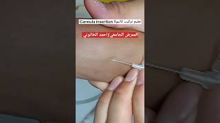 تعليم تركيب كانيولا Cannula insertion teaching