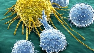 Immunotherapy Cancer Cure Giving Hope Against Leukemia