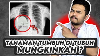 Apakah Mungkin Tanaman Tumbuh di Dalam Tubuh ?