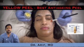 Yellow (Retinol) peel : Best Antiageing Peel@DrArifMDDermatologist #yellowpeel #retinolskincare