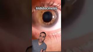 ¿Te tiembla el Ojo? 👁️