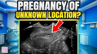 Pregnancy of unknown location - What does it mean for you?