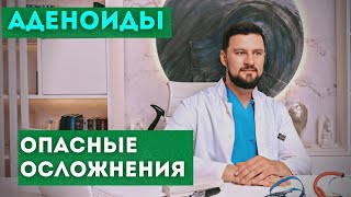 Аденоиды. Какие могут быть осложнения, если не лечить аденоиды у детей.