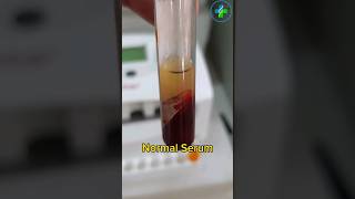 Normal Serum | Serum | Serology #medicallaboratory #bloodtest #medicallab