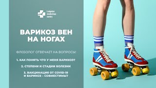 Варикоз вен на ногах. Стадии.