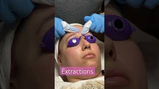 “Manual Extractions Done Properly” #extraction #fypシ゚viral #pimple #skincare #skin