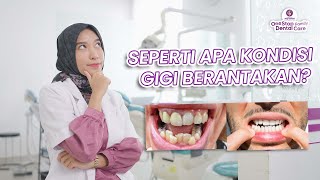 EDUKASI KONDISI GIGI BERANTAKAN BARENG DOKTER GIGINYA LANGSUNG!