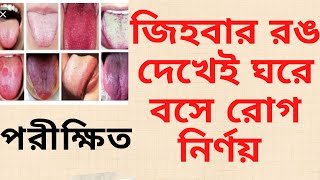 Tounge and Disease // জিভের রঙ দেখে রোগ চেনার সহজ উপায় // পরামর্শ