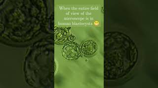 When the entire field of view of the microscope is in human blastocysts 😁 #life #embryologist #icsi