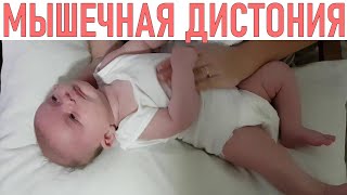 МЫШЕЧНАЯ ДИСТОНИЯ | Что делать если у вашего ребенка диагностирована мышечная дистония