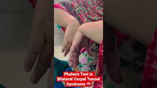 Phalen’s Test in Carpal Tunnel Syndrome #shorts #neurology #viral #shortsyoutube  #trending