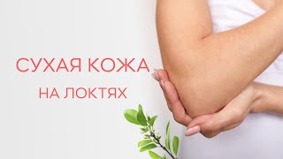 🔔​ С чем может быть связана сухость и потемнение кожи на локтях?