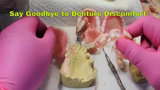 Say Goodbye to Denture Discomfort: Best Foods & Types of Partials!"